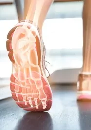 Foot Orthotic in shoe walking
