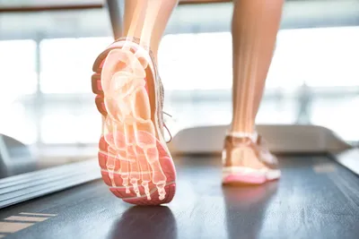 Orthotic Footwear on treadmill